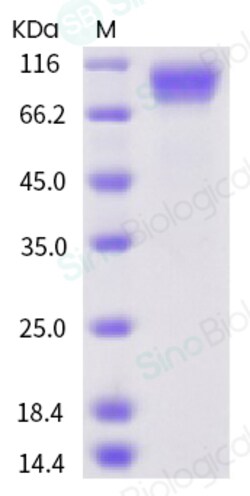 Sino Biological Human IL6ST / gp130 / CD130 Protein 100ug, Quantity: Each