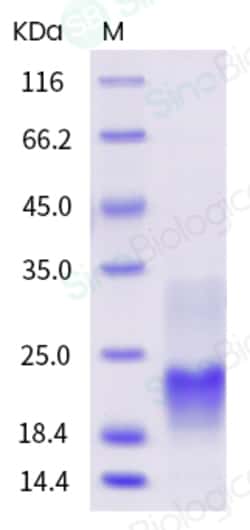 Sino Biological Human CD3e / CD3 epsilon Protein (His Tag) 500ug, Quantity: