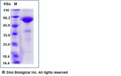 Sino Biological Human CD8a / Lyt2 Protein (Fc Tag) 1mg, Quantity: Each
