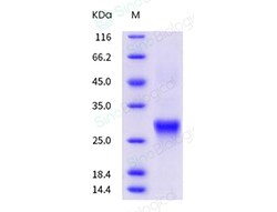 Sino Biological Human CD8A / MAL Protein (ECD, His Tag) 500ug, Quantity: