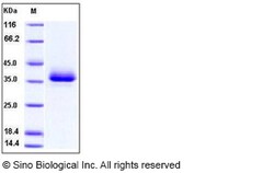 Sino Biological Recombinant Human CD2 Protein (ECD, His Tag), HPLC-verified,