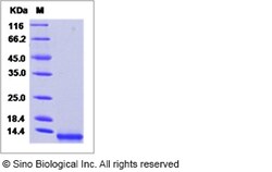 Sino Biological Recombinant Human MCP-2/CCL8 Protein (His Tag), Quantity: