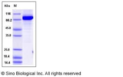 Sino Biological Recombinant Human NAMPT Protein (His & GST Tag), HPLC-verified,