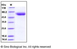 Sino Biological Human SerpinA7 / TBG Protein (His Tag) 50ug, Quantity:
