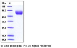 Sino Biological Human Angiotensinogen / SerpinA8 / AGT Protein (His Tag)
