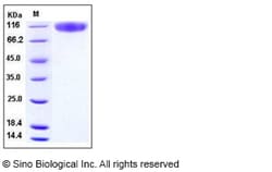Sino Biological Recombinant Human C1 inhibitor/C1-INH Protein (His Tag),