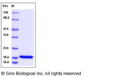 Sino Biological Recombinant Human KIAA0101 Protein (His Tag), Quantity: