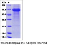 Sino Biological Recombinant Human Tomoregulin-1 Protein (ECD, hFc Tag),