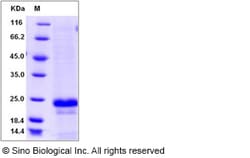 Sino Biological Recombinant Human CD20 Protein (aa 213-297, His Tag), HPLC-verified,