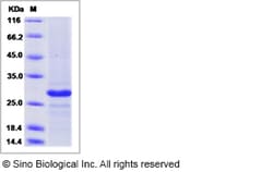 Sino Biological Human CD20 / MS4A1 Protein (TrxA Tag), Biotinylated 20ug,
