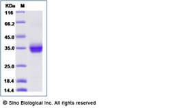 Sino Biological Human ANGPTL2 / Angiopoietin-like 2 Protein (His Tag) 100ug,