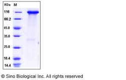 Sino Biological Recombinant Human HK3 Protein (His & GST Tag), Quantity: