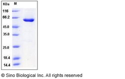 Sino Biological Human CSNK2A2 / CK2A2 Protein (His & GST Tag) 50ug, Quantity: