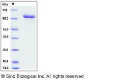 Sino Biological Recombinant Anti-Factor IX Antibody, Rabbit Monoclonal,