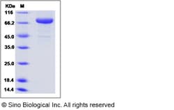 Sino Biological Human Transferrin Receptor / TFRC / CD71 Protein (ECD,