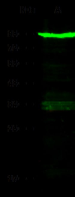 Sino Biological Human TFRC MAb 100ul (Sino Biological), Quantity: Each