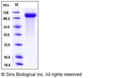 Sino Biological Recombinant Human IL-22BP Protein (His & hFc Tag), Quantity: