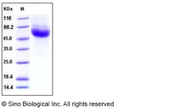 Sino Biological Human IL22BP / IL22RA2 Protein (His Tag) 50ug, Quantity: