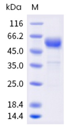 Sino Biological Human CD7 Protein 1MG (Sino Biological), Quantity: Each