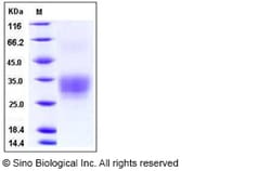 Sino Biological Human CD7 Protein (His Tag) 100ug, Quantity: Each of 1