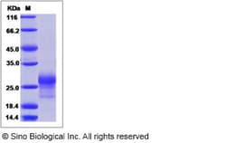 Sino Biological Recombinant Human CD8 beta Protein, HPLC-verified, Quantity: