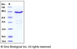 Sino Biological Human PHKG1 Protein (GST Tag) 50ug, Quantity: Each of 1