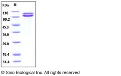 Sino Biological Recombinant Human N-Cadherin Protein (His Tag), Quantity: