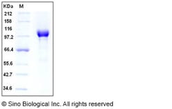 Sino Biological Recombinant Human PARP-1 Protein (His Tag), HPLC-verified,