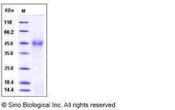 Sino Biological Human SFTPD / SP-D / SFTP4 Protein (His Tag) 100ug, Quantity: