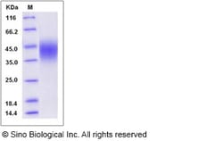 Sino Biological Human CD16b / FCGR3B Protein (NA2 allotype, His Tag) 100ug,