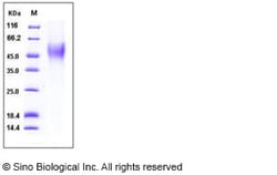 Sino Biological Human CD16b / FCGR3B Protein (His Tag, NA2 allotype) 100ug,