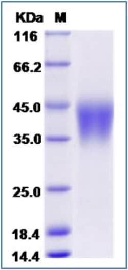 Sino Biological Human CD16B / FCGR3B Protein (His Tag, NA1 allotypes) 100ug,