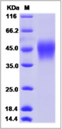 Sino Biological Human CD16B / FCGR3B Protein (His Tag, SH allotype) 100ug,