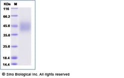 Sino Biological Human CD16b / FCGR3B Protein (NA2 allotype, His & AVI Tag),