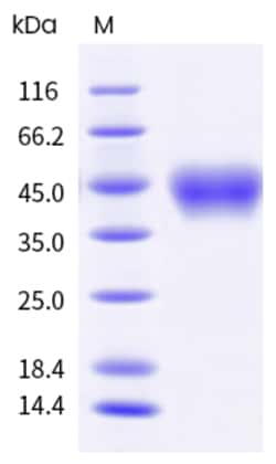 Sino Biological Recombinant Human CD16b/FCGR3B/Fc gamma RIIIB Protein (NA1