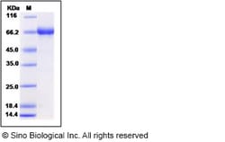Sino Biological Influenza A H5N1 (A/Anhui/1/2005) Hemagglutinin / HA Protein