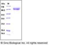 Sino Biological Influenza A H5N1 (A/Anhui/1/2005) Hemagglutinin / HA Protein