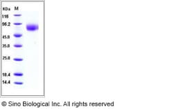 Sino Biological Influenza A H5N1 (A/Anhui/1/2005) Hemagglutinin Protein