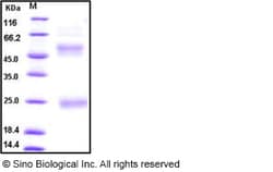 Sino Biological Influenza A H5N1 (A/Anhui/1/2005) Hemagglutinin / HA Protein