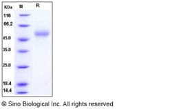 Sino Biological Influenza A H5N1 (A/Anhui/1/2005) Hemagglutinin Protein