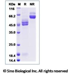Sino Biological Human respiratory syncytial virus (RSV) (A2) Fusion glycoprotein