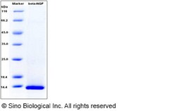 Sino Biological Human β-NGF / Beta-NGF Protein 100ug, Quantity: Each of