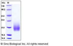 Sino Biological Human KIM-1 / TIM1 / HAVCR1 Protein (aa 1-135, His Tag)