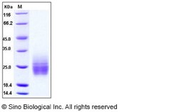 Sino Biological Recombinant Human TIM-1/HAVCR1 Protein (aa 1-135, His Tag),