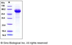 Sino Biological Influenza B (B/Florida/4/2006) Hemagglutinin Protein (HA2
