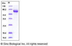 Sino Biological Influenza B (B/Florida/4/2006) Hemagglutinin Protein (HA2