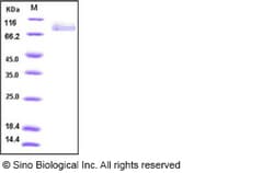 Sino Biological Influenza B (B/Florida/4/2006) Hemagglutinin / HA Protein