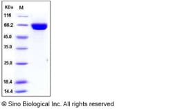 Sino Biological Influenza A H1N1 (A/California/04/2009) Hemagglutinin /