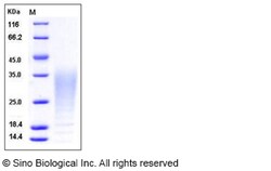 Sino Biological Recombinant Cynomolgus IL-13 Protein (His Tag), Quantity: