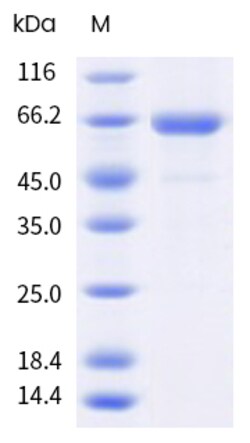 Sino Biological&nbsp;Influenza A H1N1 (A/California/04/2009) Neuraminidase / NA Protein (AVI & His Tag), Biotinylated 20